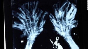 x-ray-tree-man